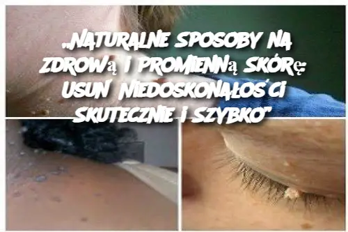 „Naturalne Sposoby na Zdrową i Promienną Skórę: Usuń Niedoskonałości Skutecznie i Szybko”