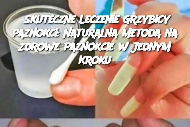 Skuteczne Leczenie Grzybicy Paznokci: Naturalna Metoda na Zdrowe Paznokcie w Jednym Kroku