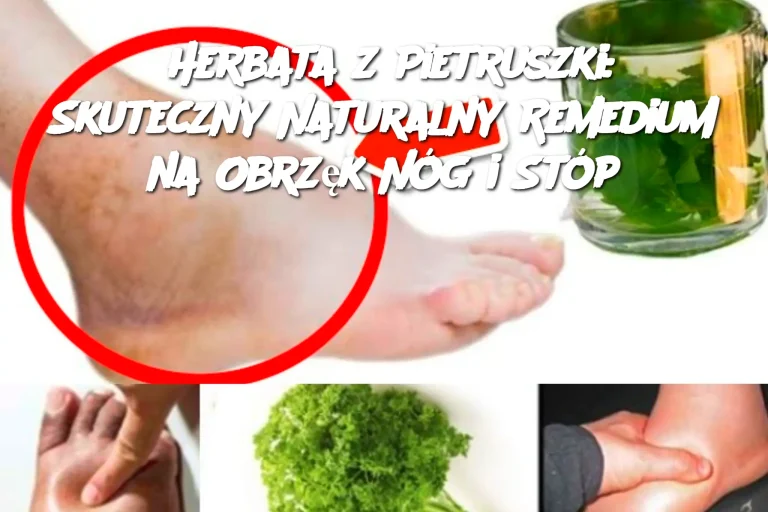 Herbata z Pietruszki: Skuteczny Naturalny Remedium na Obrzęk Nóg i Stóp