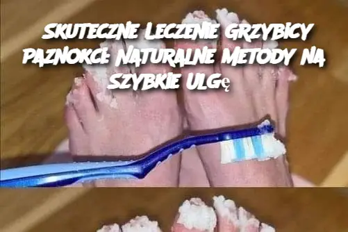 Skuteczne Leczenie Grzybicy Paznokci: Naturalne Metody na Szybkie Ulgę