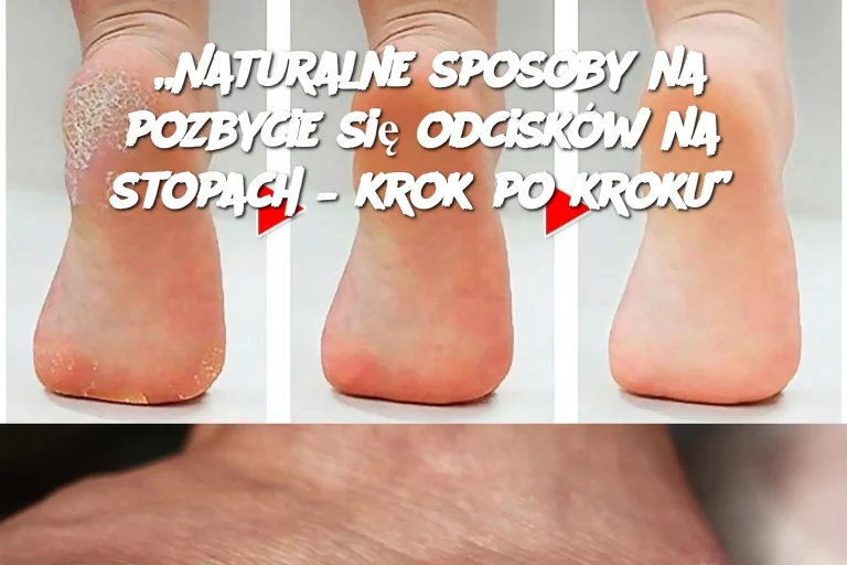 „Naturalne sposoby na pozbycie się odcisków na stopach – krok po kroku”