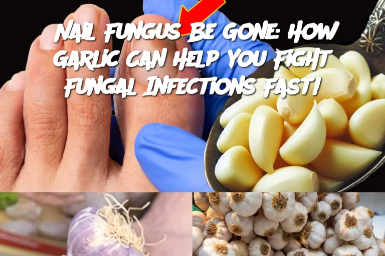 Nail Fungus Be Gone: How Garlic Can Help You Fight Fungal Infections Fast!