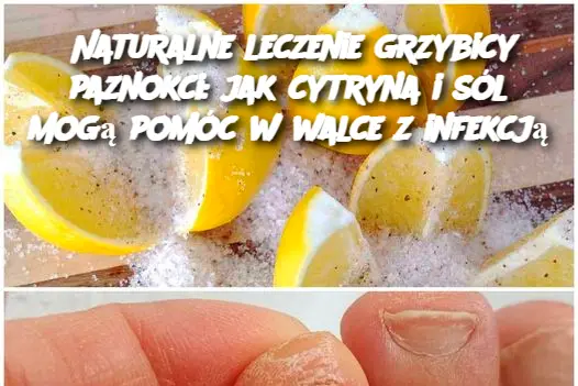 Naturalne leczenie grzybicy paznokci: jak cytryna i sól mogą pomóc w walce z infekcją