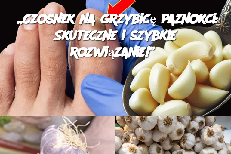 „Czosnek na grzybicę paznokci: Skuteczne i szybkie rozwiązanie!”