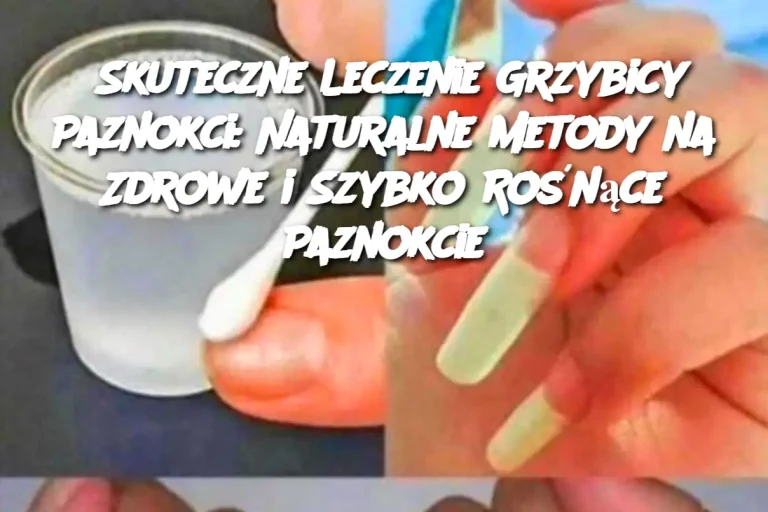 Skuteczne Leczenie Grzybicy Paznokci: Naturalne Metody na Zdrowe i Szybko Rośnące Paznokcie