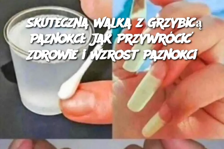 Skuteczna Walka z Grzybicą Paznokci: Jak Przywrócić Zdrowie i Wzrost Paznokci