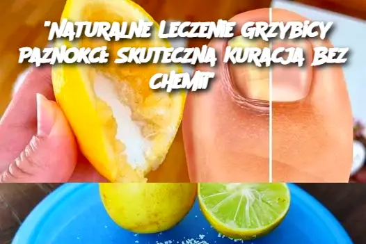 "Naturalne Leczenie Grzybicy Paznokci: Skuteczna Kuracja Bez Chemii"