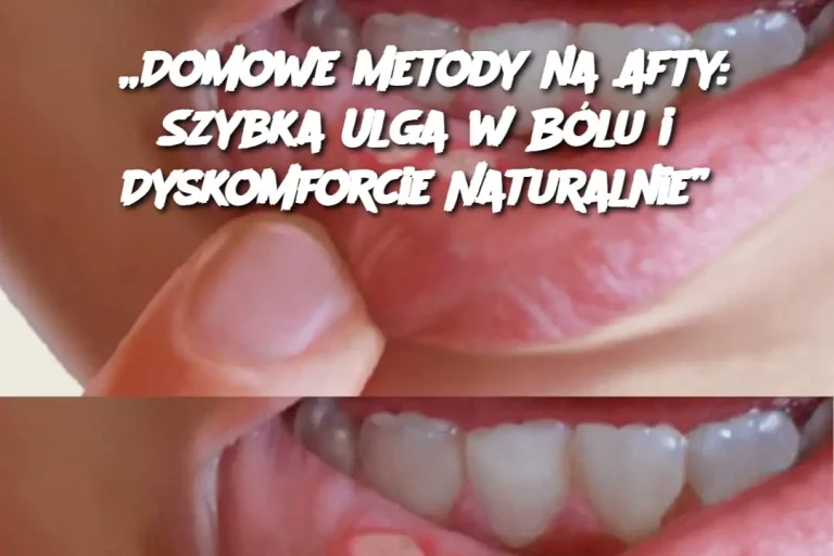 „Domowe Metody na Afty: Szybka Ulga w Bólu i Dyskomforcie Naturalnie”