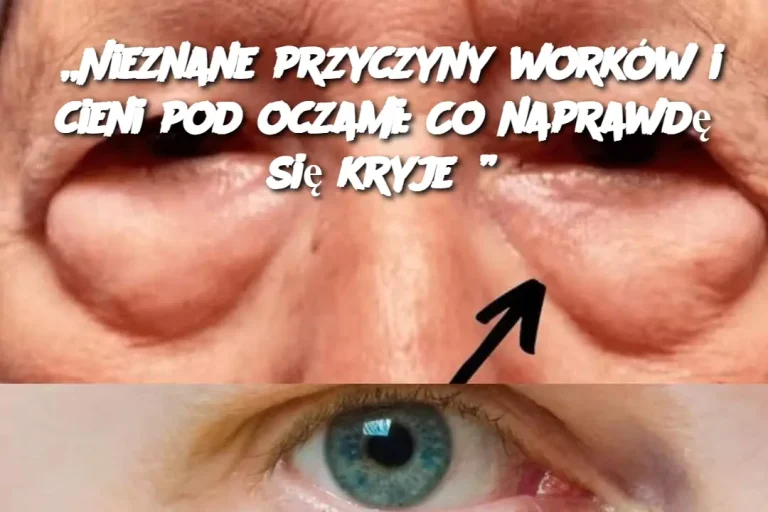 „Nieznane przyczyny worków i cieni pod oczami: Co naprawdę się kryje?”