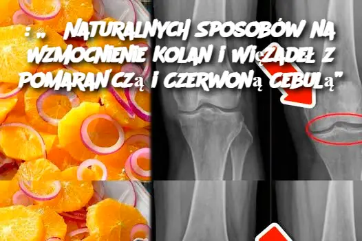 : „8 Naturalnych Sposobów na Wzmocnienie Kolan i Więzadeł z Pomarańczą i Czerwoną Cebulą”