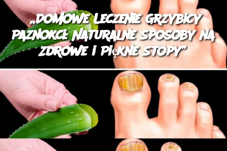 „Domowe Leczenie Grzybicy Paznokci: Naturalne Sposoby na Zdrowe i Piękne Stopy”