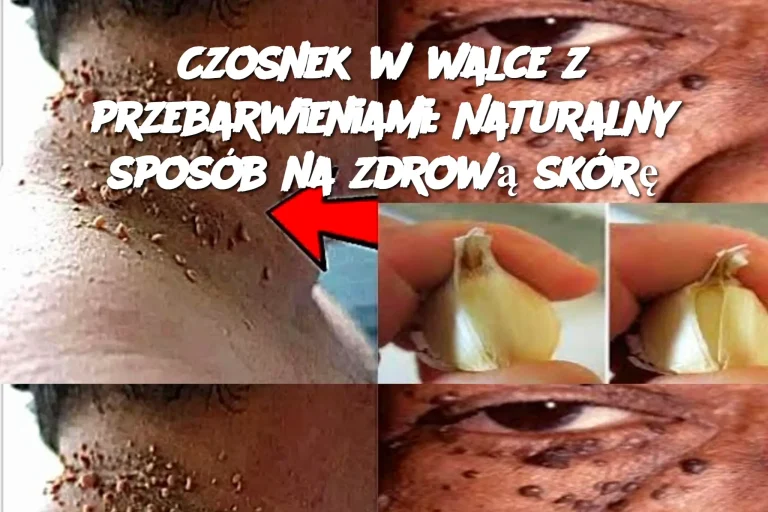 Czosnek w walce z przebarwieniami: Naturalny sposób na zdrową skórę