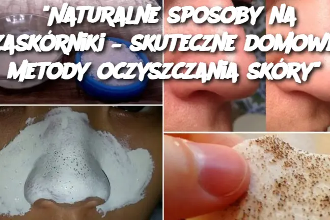 "Naturalne sposoby na zaskórniki – skuteczne domowe metody oczyszczania skóry"