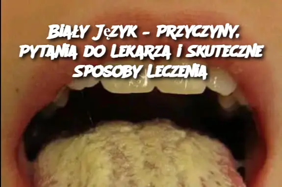 Biały Język – Przyczyny, Pytania do Lekarza i Skuteczne Sposoby Leczenia