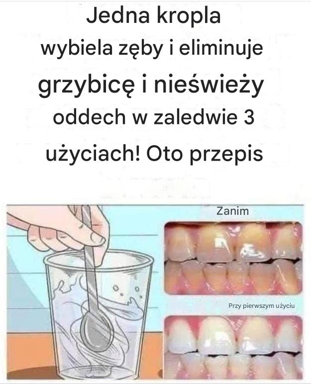Naturalny sposób na bielszy uśmiech – przepis na domowy środek do usuwania kamienia nazębnego