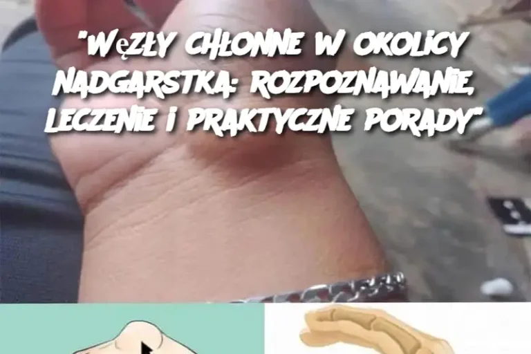 "Węzły chłonne w okolicy nadgarstka: rozpoznawanie, leczenie i praktyczne porady"