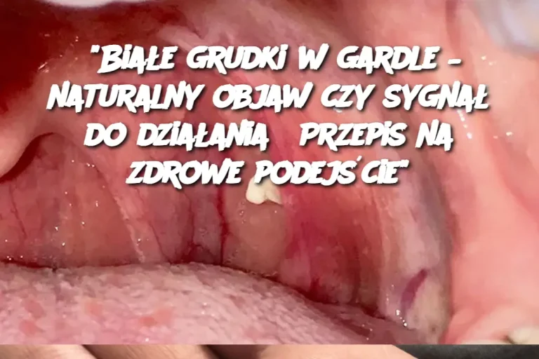 "Białe grudki w gardle – naturalny objaw czy sygnał do działania? Przepis na zdrowe podejście"
