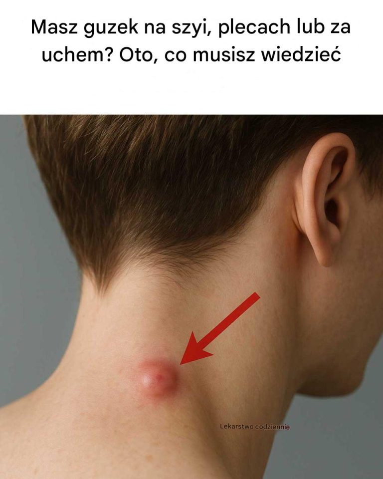 Tajemniczy guzek na szyi, plecach lub za uchem? Sprawdź, co może oznaczać i jak postępować