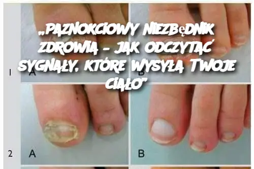 „Paznokciowy niezbędnik zdrowia – jak odczytać sygnały, które wysyła Twoje ciało”