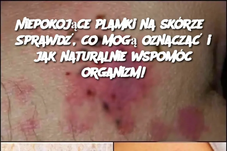 Niepokojące plamki na skórze? Sprawdź, co mogą oznaczać i jak naturalnie wspomóc organizm!