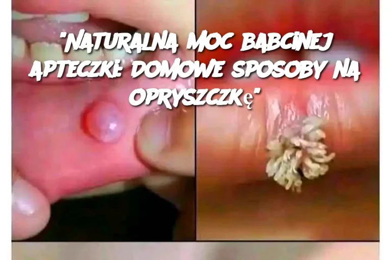 "Naturalna moc babcinej apteczki: Domowe sposoby na opryszczkę"