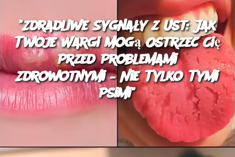 "Zdradliwe Sygnały z Ust: Jak Twoje Wargi Mogą Ostrzec Cię Przed Problemami Zdrowotnymi – Nie Tylko Tymi Psimi"