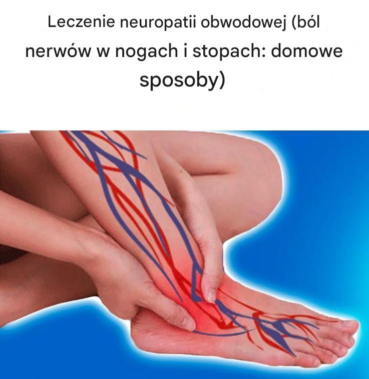 Leczenie neuropatii obwodowej [Ból nerwów w nogach i stopach: domowe sposoby]