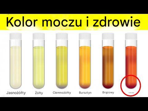 Co kolor moczu mówi o Twoim zdrowiu